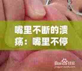 嘴里不断的溃疡:嘴里不停地长溃疡