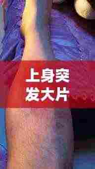 上身突发大片红斑,原因、症状与处理方法探讨